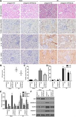 Corrigendum: Identification of microRNA-92a-3p as an essential regulator of tubular epithelial cell pyroptosis by targeting Nrf1 via HO-1